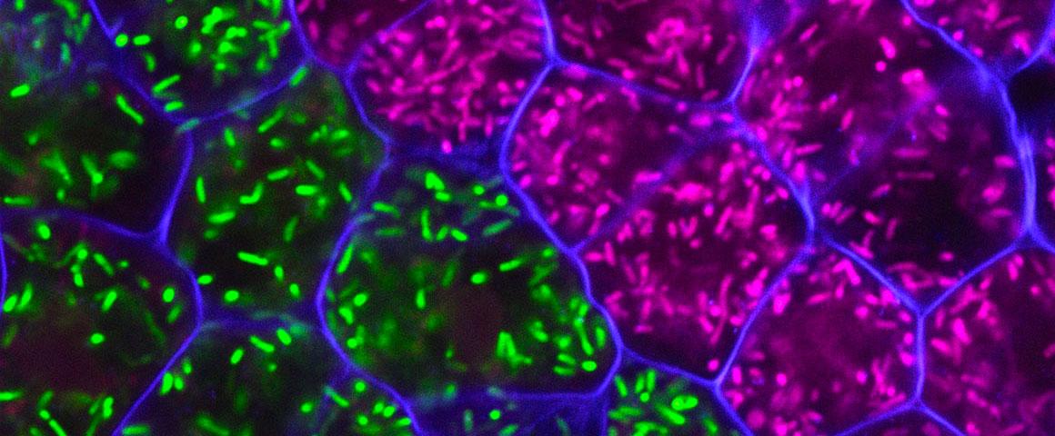 Nodule fixateur d'azote. © MSLT/LSTM