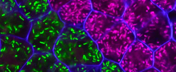 Nodule fixateur d'azote. © MSLT/LSTM